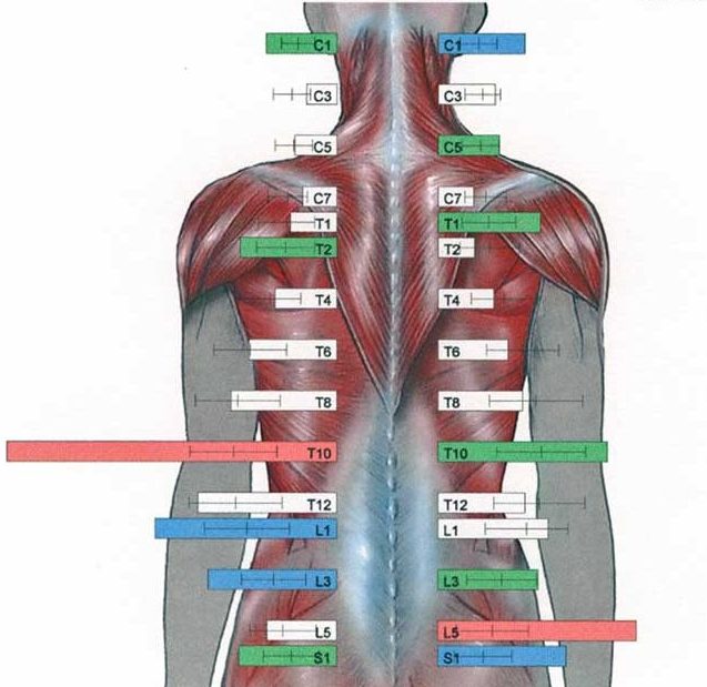Back & Neck Pain A scan showing sources of back and neck pain