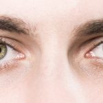Man suffers from loss of gaze fixation after a concussion in Canada